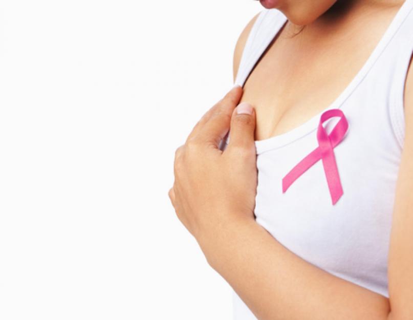 أعراض سرطان الثدي.  متى يجب أن ترى الطبيب؟  الوقاية من سرطان الثدي.