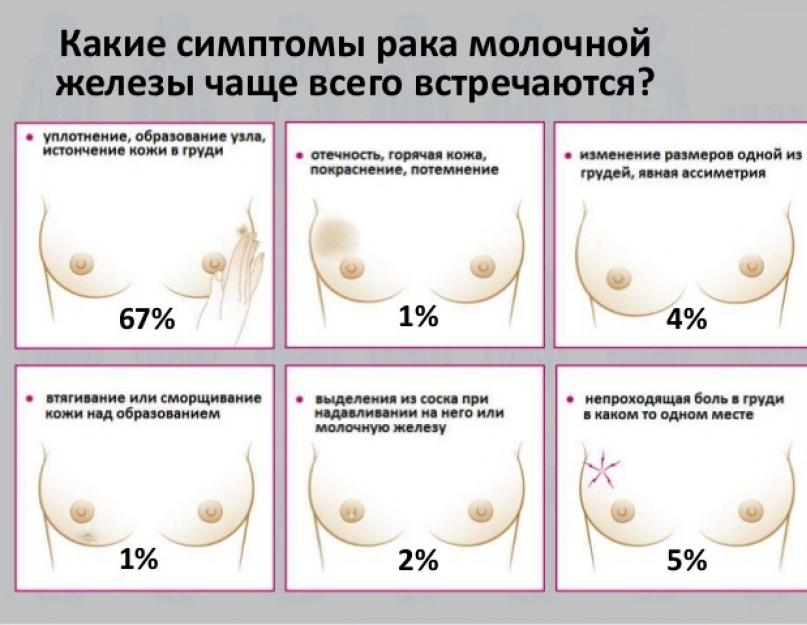 सौम्य स्तन ट्यूमर के लक्षण उपचार।  स्तन कैंसर कैसा दिखता है: फोटो और उपस्थिति का विवरण