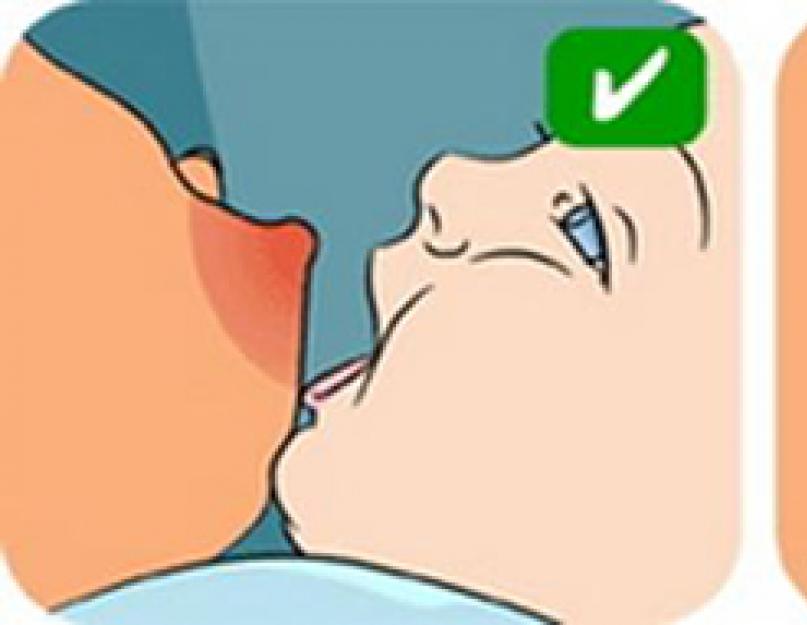 ملامح التطبيق الصحيح للطفل أثناء الرضاعة الطبيعية.  التعلق الصحيح للرضيع بالثدي.