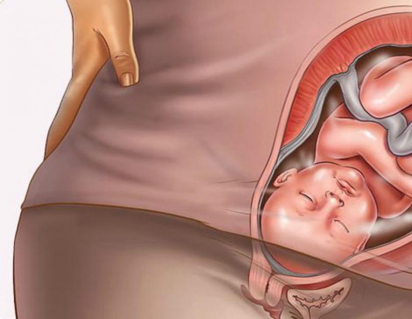 كيف تتجلى نبرة الرحم.  نبرة الرحم المتزايدة: أمراض أم حالة خاصة للحمل؟  علاج زيادة توتر الرحم أثناء الحمل