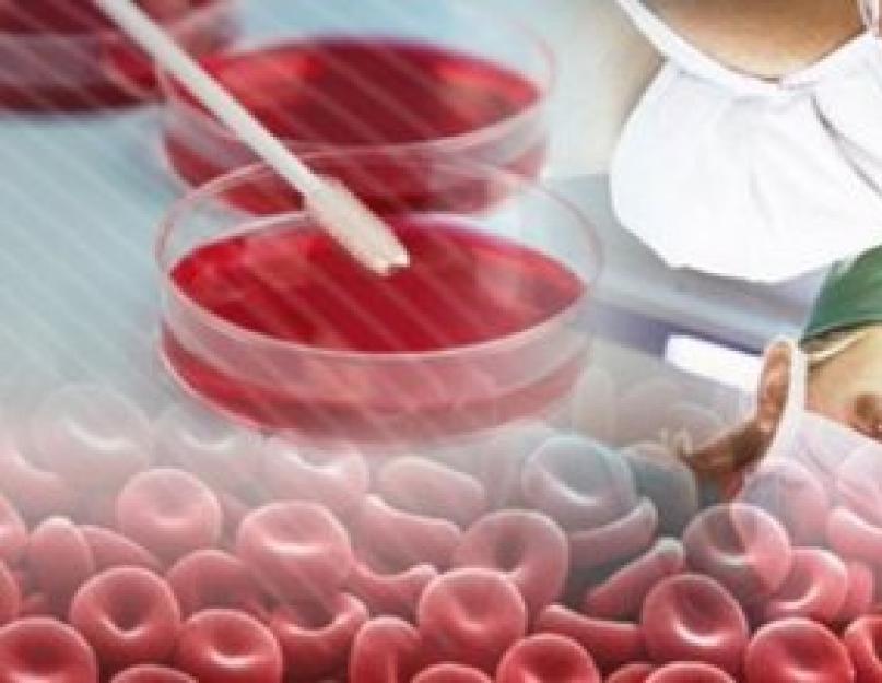 Что такое ремиссия при раке крови. Что означает ремиссия в онкологии? Профилактика и лечебная физкультура